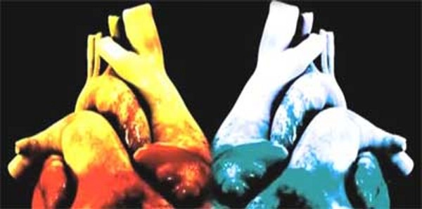 Sonja Laura Armanjako